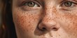 Close up portrait of a beautiful girl with freckles. Problem skin face, freckle on face. Celebration of Self