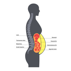 Sticker - Visceral fat diagram