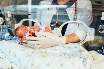 Wall Mural - Unrecognizable nurse in white gloves takes action and care for premature baby, selective focus on baby eye. Newborn is placed in the incubator. Neonatal intensive care unit.