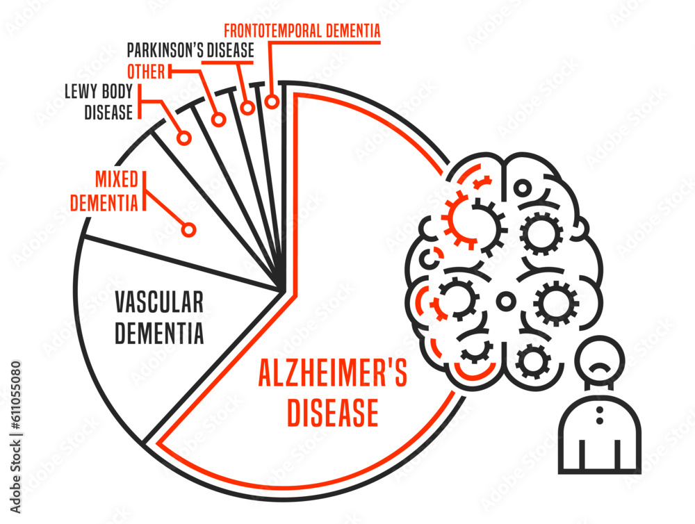 Vector dementia infographic in outline style. Editable illustration ...