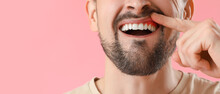 Man With Gum Inflammation On Pink Background, Closeup