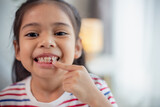 Fototapeta Do pokoju - Little Asian girl showing her broken milk teeth.