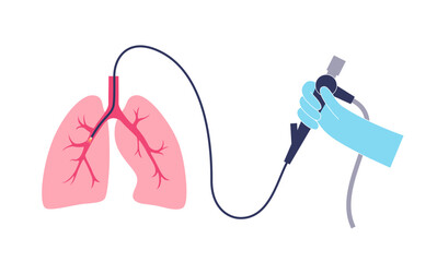 Canvas Print - Bronchoscopy procedure concept