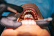 © Atolas/Stocksy - Closeup of teeth exam