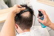 © Alvaro Lavin/Stocksy - bald man with a wigbald man changing his hair prosthesis wig in esthet