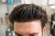 © Alvaro Lavin/Stocksy - bald man with wig being styled in beauty salon