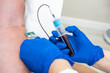© Alvaro Lavin/Stocksy - doctor drawing blood from patient