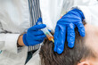 © Alvaro Lavin/Stocksy - doctor injecting blood plasma into the scalp