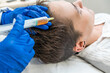© Alvaro Lavin/Stocksy - doctor injecting blood plasma into the scalp