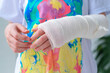 Close-up of a broken arm of a child in a cast. The girl holds her hand bent