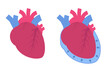 Pericardial effusion concept. Cardiovascular system medical vector illustration.