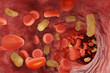 Red blood cells and yellow bacteria flowing in blood vessel. Illustration of the concept of a severe medical condition sepsis in which bacteria enter the blood