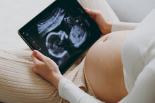 Cropped Close Up Young Pregnant Woman Wears White Pyjamas Hold In Hand Picture Of Ultrasound Examination Rest Relax Spend Time In Bedroom Lounge Home. Maternity Family Pregnancy Expectation Concept.