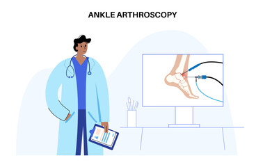 Poster - Ankle arthroscopy poster