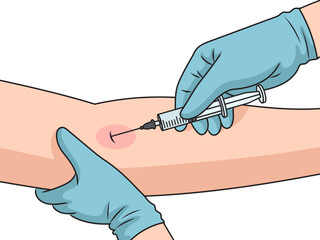 Canvas Print - Injection of medicine with syringe in hand intravenous injection schematic vector illustration. Medical science educational illustration