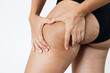 © Марина Демешко - Cropped shot of a young tanned woman in black panties squeezing skin on her thigh with cellulite isolated on a white background. Excess weight, overweight. Flabby sagging skin