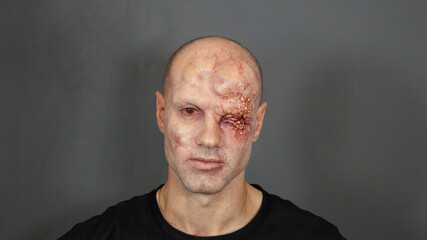 Fototapeta balding mutant man with bad skin 