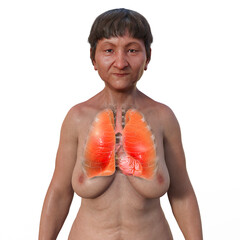 Canvas Print - A 3D illustration of the upper half part of a female patient with transparent skin, showcasing a pair of healthy lungs in intricate detail