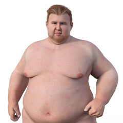 Poster - A 3D scientific illustration of an overweight white-skinned man