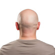 the back of a bald man's head