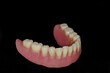 © adel - Close-up human denture of the lower jaw on a black background