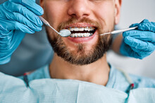 Cropped Portrait Of Handsome Man With Braces Sitting In Dental Chair. Doctor In Gloves Holding Examination Tools Behind. Braces, Alignment Of Teeth.