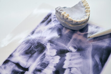 Wall Mural - Snapshot of the dentition lie on the table