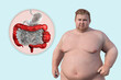 An overweight man with the presence of large intestine spasms associated with irritable bowel syndrome, 3D illustration