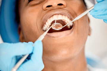 Canvas Print - Dentist, black woman mouth and patient at a clinic with medical and healthcare for teeth cleaning. Mirror, orthodontist and African female person with wellness and dental work tool with care