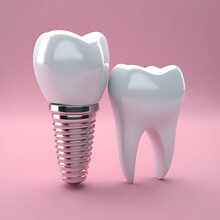 An Implant And A Tooth On A Pink Background, In The Style Of Light Sky-blue And Dark Silver, Photorealistic Renderings, Princesscore, White Background, Sanriocore, Transfer, Close Up