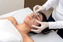 Young Woman On A Table In A Beauty Center Performing A Beauty Treatment For Facial Skin With The Dermaplaning Technique