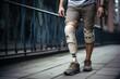 man walking with Futuristic Cybernetic Prosthetic Leg Revolutionizes Rehabilitation