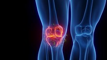 Animation Of A Man's Inflamed Right Knee Undergoing Healing