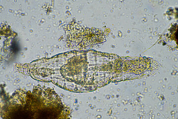 Wall Mural - rotifer in a soil sample