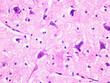 Histology of Human Brain Tissue Viewed at 400x Magnification with Haemotoxylin and Eosin Staining.