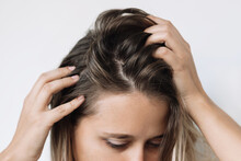 Cropped Shot Of A Young Caucasian Blonde Woman With Dirty Greasy Hair On A White Background. The Problem Of Oily Scalp. Itching Of The Skin From Long Non-washes Of The Head