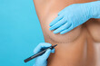 Breast augmentation. Doctor with marker preparing woman for plastic surgery operation against light blue background, closeup. Space for text