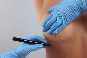 Breast augmentation. Doctor with marker preparing woman for plastic surgery operation against light grey background, closeup. Space for text.