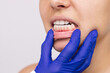 © Марина Демешко - Wrong bite. Cropped shot of young woman's face with doctor's hand in a blue glove showing healthy gums isolated on a white background. Examination at the dentist. Dentistry, dental care. Malocclusion