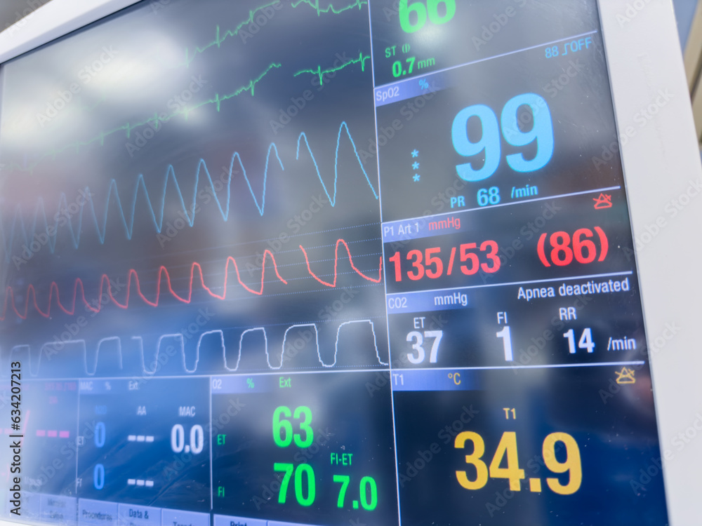 Low O2 Monitor Hospital Hospital monitors display vital signs: heart rate, oxygen saturation ...