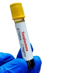 Sticker - Blood sample for Toxoplasma test