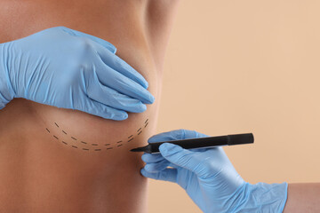 Poster - Breast augmentation. Doctor with marker preparing woman for plastic surgery operation against beige background, closeup. Space for text.