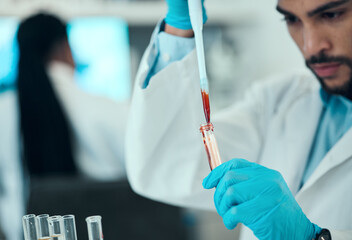 Poster - Scientist, man with blood in pipette and test in laboratory research, results and medical engineering. Biotechnology, pharmaceutical study and DNA lab technician with liquid solution in glass.