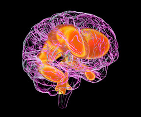 Poster - Enlarged ventricles of the child brain, 3D illustration