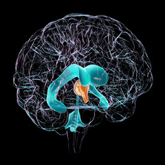 Wall Mural - Enlarged third ventricle of the brain, 3D illustration