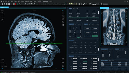 Aufkleber - 3D Render: Magnetic Resonance Imaging Brain and Spinal Cord Scan Mock-up with Multiple Windows and Data. Medical Research Software Template with MRI Results for Computer Displays and Laptop Screens.