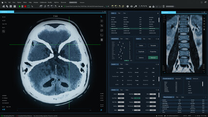 Aufkleber - 3D Render: Magnetic Resonance Imaging Brain and Spinal Cord Scan Mock-up with Multiple Windows and Data. Medical Research Software Template with MRI Results for Computer Displays and Laptop Screens.