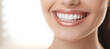 Snow-white smile, healthy teeth. Female smile after teeth whitening procedure. Problems of dentistry (Generative AI)