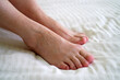 © lesslemon - female legs with problem with women's feet, bunion toes in bare feet. Hallus valgus