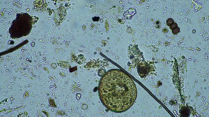 Wall Mural - Fungal and fungi hyphae under the microscope in the soil and compost, in a soil biology and microorganism test